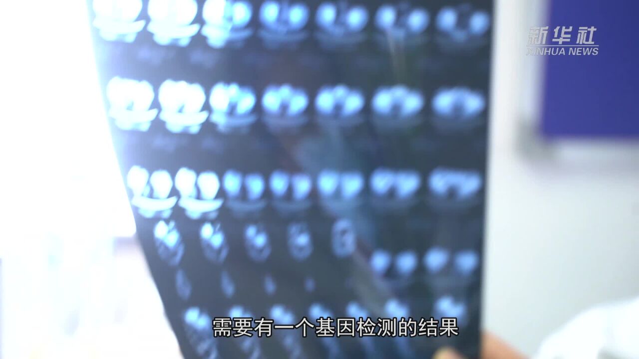 关注卵巢癌 专家这样提醒