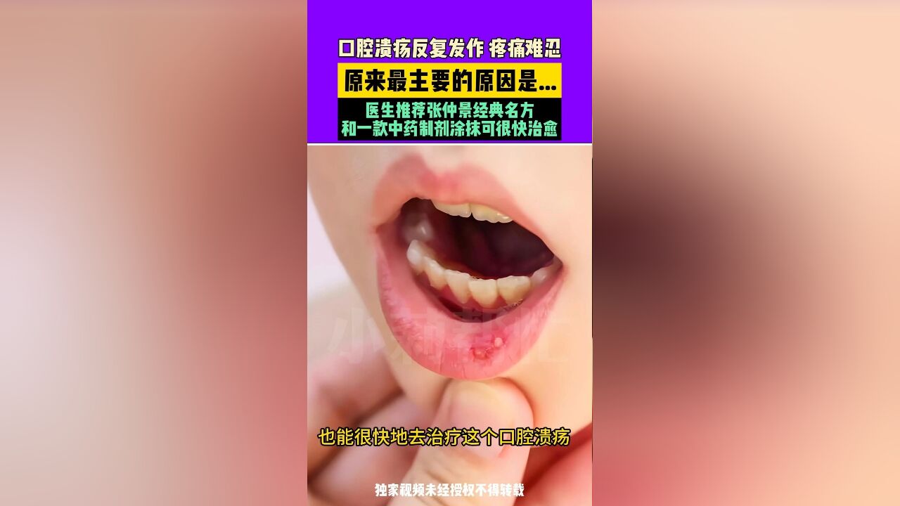 口腔溃疡反复发作疼痛难忍,原来最主要的原因是...,医生推荐张仲景经典名方和一款中药制剂涂抹可很快治愈