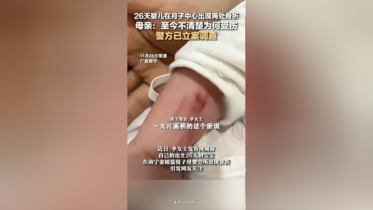 26天婴儿在月子中心出现两处骨折,母亲:至今不清楚为何受伤,警方已立案调查