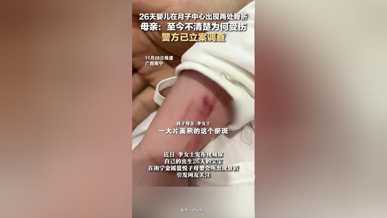 26天婴儿在月子中心出现两处骨折,母亲:至今不清楚为何受伤,警方已立案调查