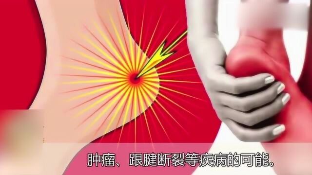 脚后跟经常痛怎么办?3个小妙招帮你解决