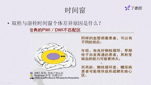 静脉溶栓时间窗