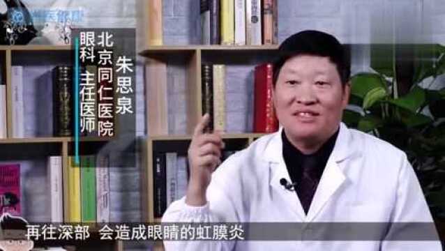 “红眼病”是高发传染疾病,两个危害要注意,治疗也不可懈怠