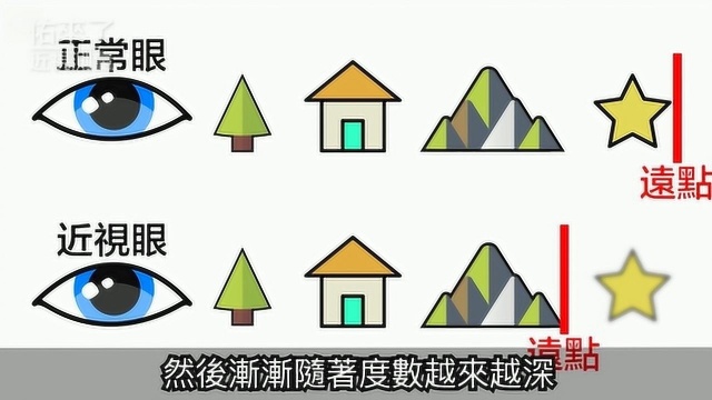 想自己测量近视度数?教你超简单的视力检测方法!