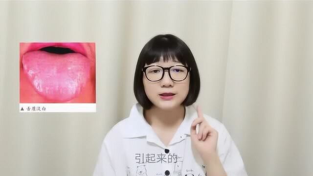 不同的舌质颜色反映不同的身体健康问题,快看看你是属于哪一种吧