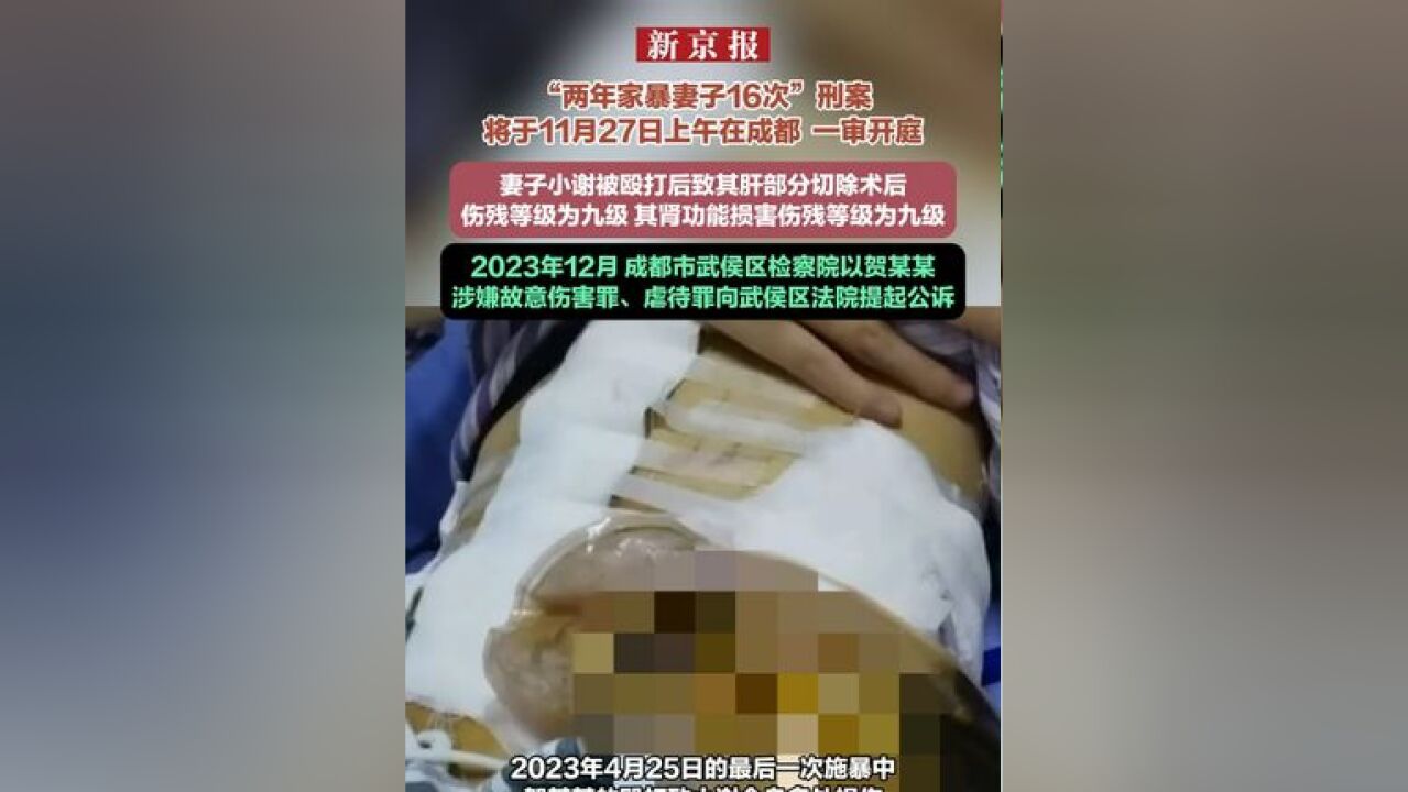 “两年家暴妻子16次”刑案将于11月27日上午在成都 一审开庭 小谢被殴打后致其肝部分切除术后 伤残等级为九级