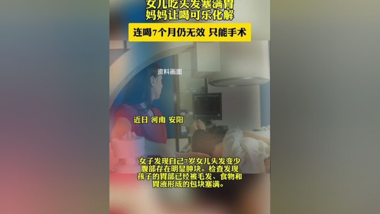 女儿胃里长结石妈妈让喝7个月可乐仍无效,只能手术