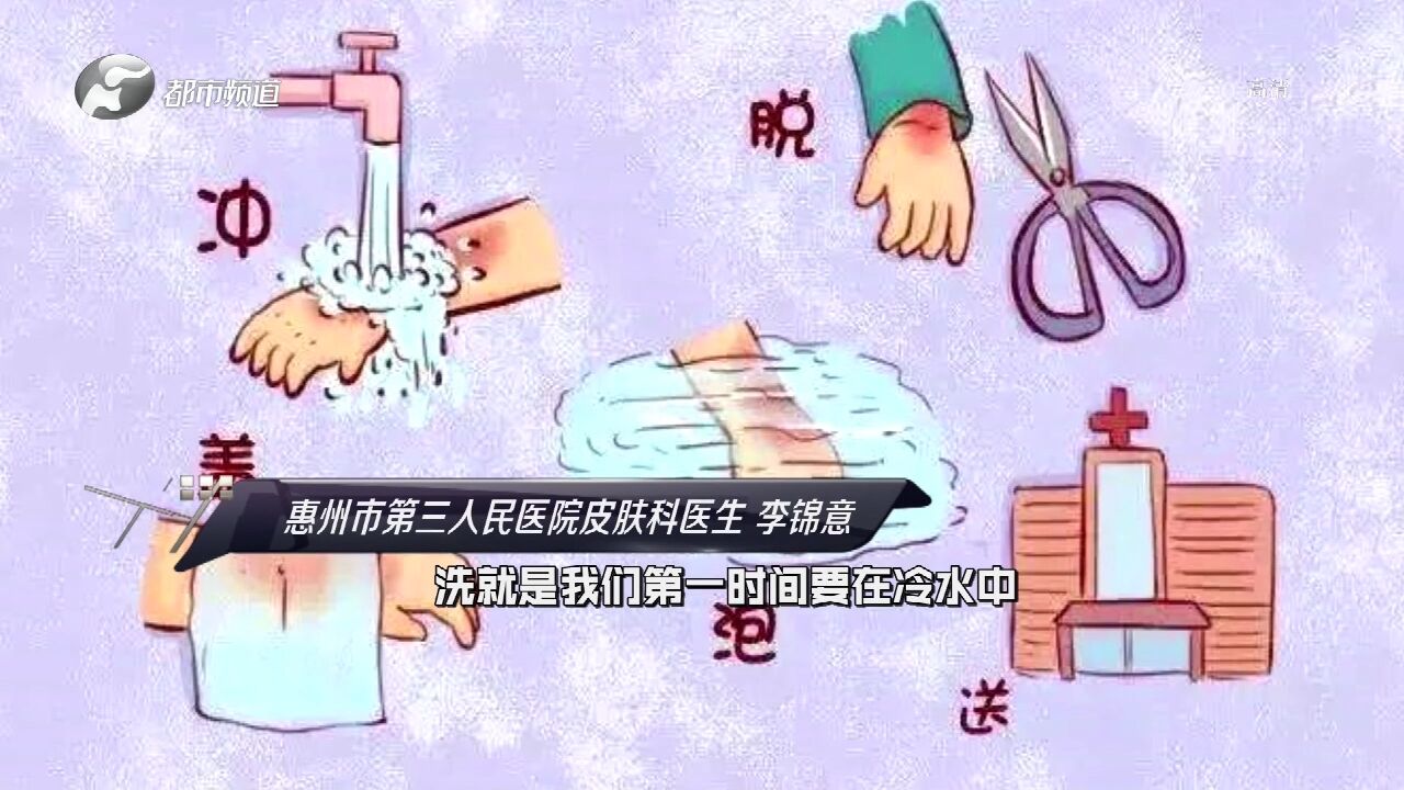 低温烫伤后怎么处理?记住这“五字口诀”,可有效减轻伤害!