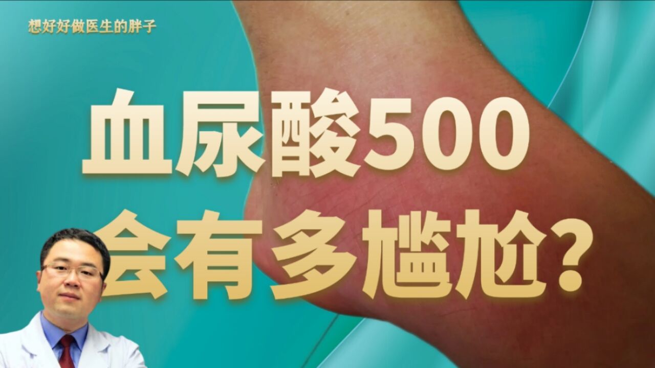 血尿酸500真尴尬,是否需要药物降尿酸?看完这个视频困扰消失