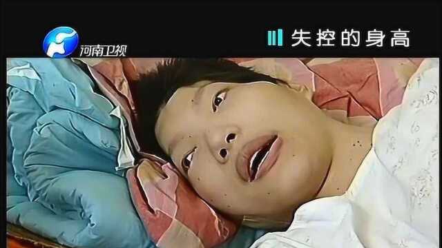 女巨人可怕的身高,毁了她的一生,什么都做不了躺在床上竟最安全!