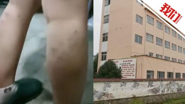 贵州余庆通报“老师围殴学生”事件:4教师用教鞭体罚 共9人被处理