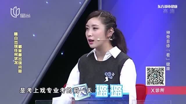 眼睛中的眼白有变化,是什么哪部位出问题?早知道早预防