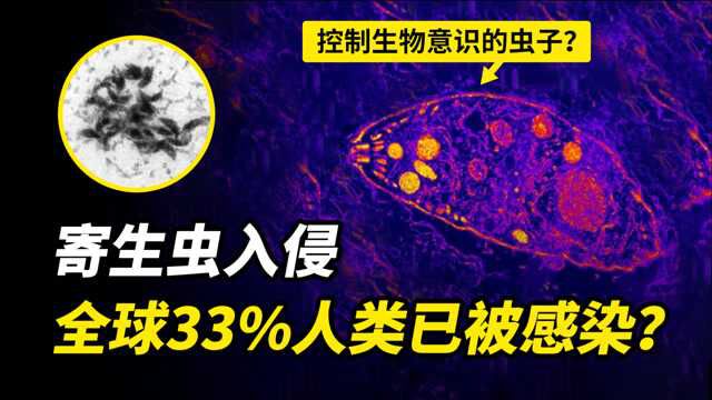 操控意识的寄生虫?全世界33%人类已被感染?刚地弓形虫