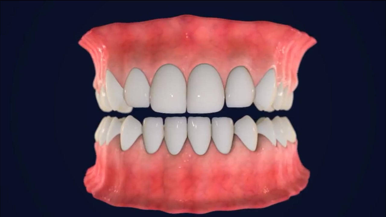 Thumbplayer Poster Plugin Image