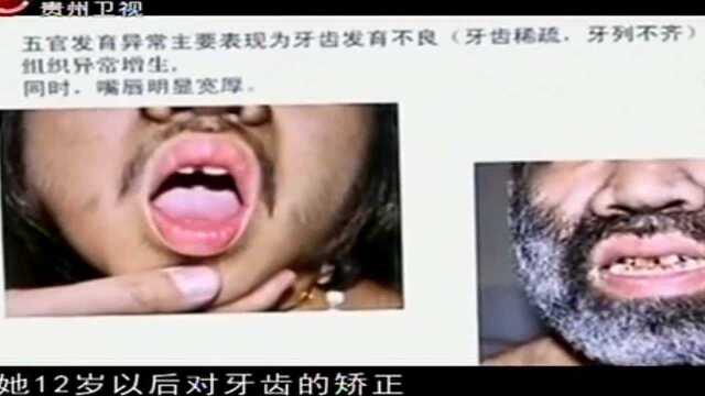 全身长浓毛的姑娘,好想穿漂亮裙子丨真相