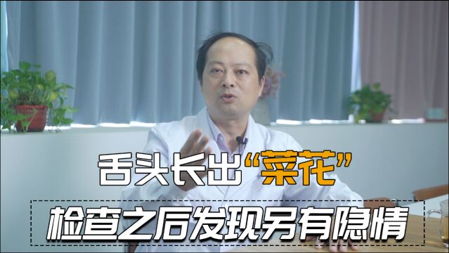 60岁老太舌头长“菜花”是舌癌?医生:口腔溃疡也要引起重视!