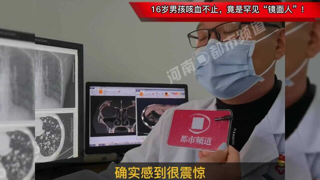 16岁男孩咳血不止,竟是罕见“镜面人”!