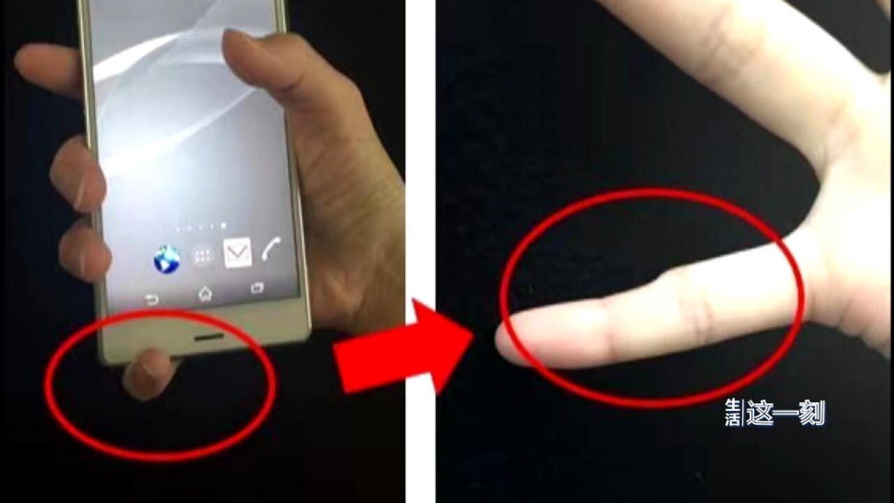 网传玩手机会致小指畸形是真的吗?