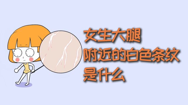 女生大腿附近的,白色条纹是什么?