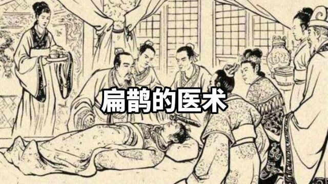 扁鹊的医术