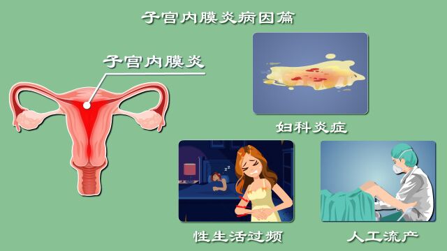 妇科炎症咋来的?性生活过频、人流惹的祸?三分钟让你做个明白女人