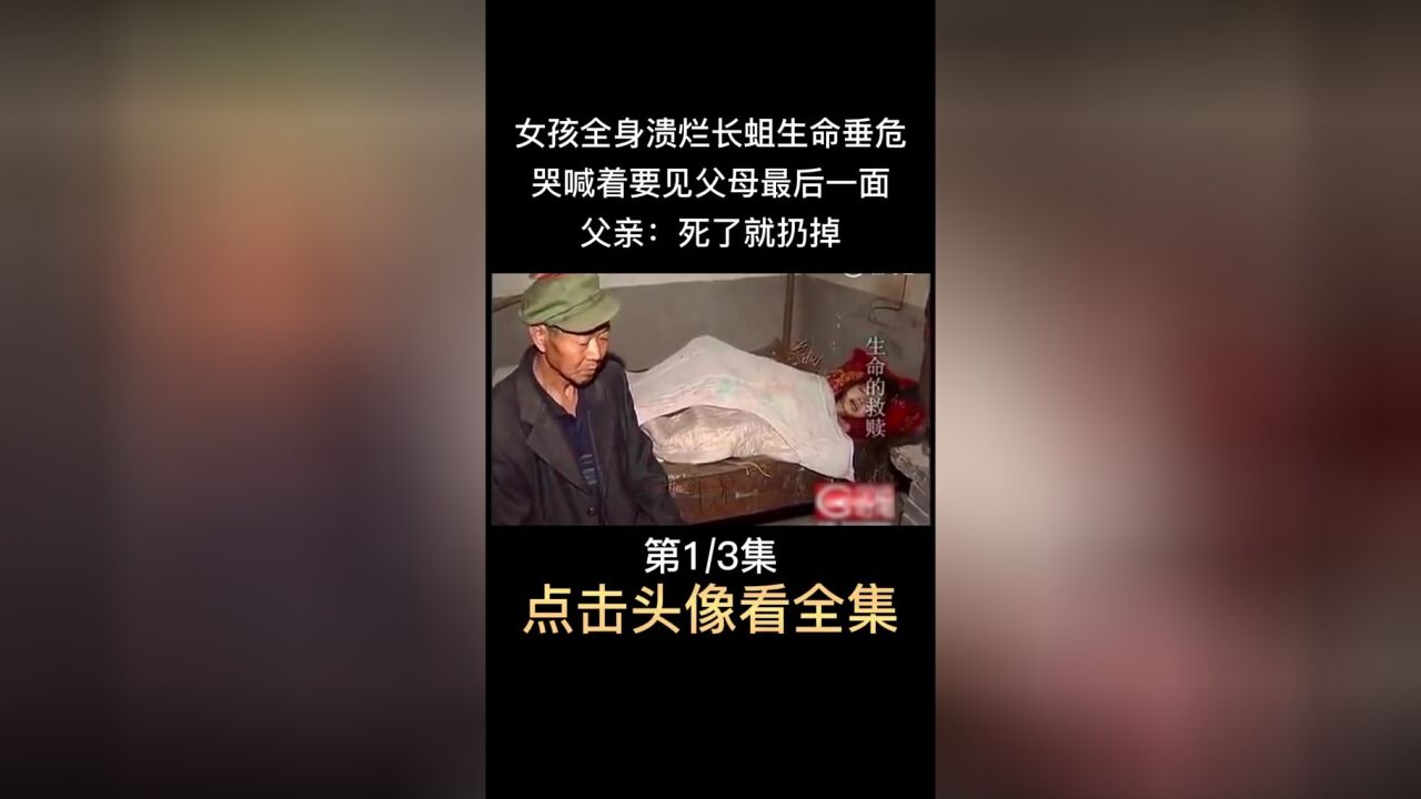 女孩全身溃烂长蛆生命垂危,哭喊着要见父母最后一面,父亲:死了就扔掉