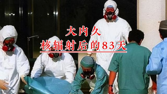 日本工人大内久:接触20000倍核辐射到死亡,镜头下的83天