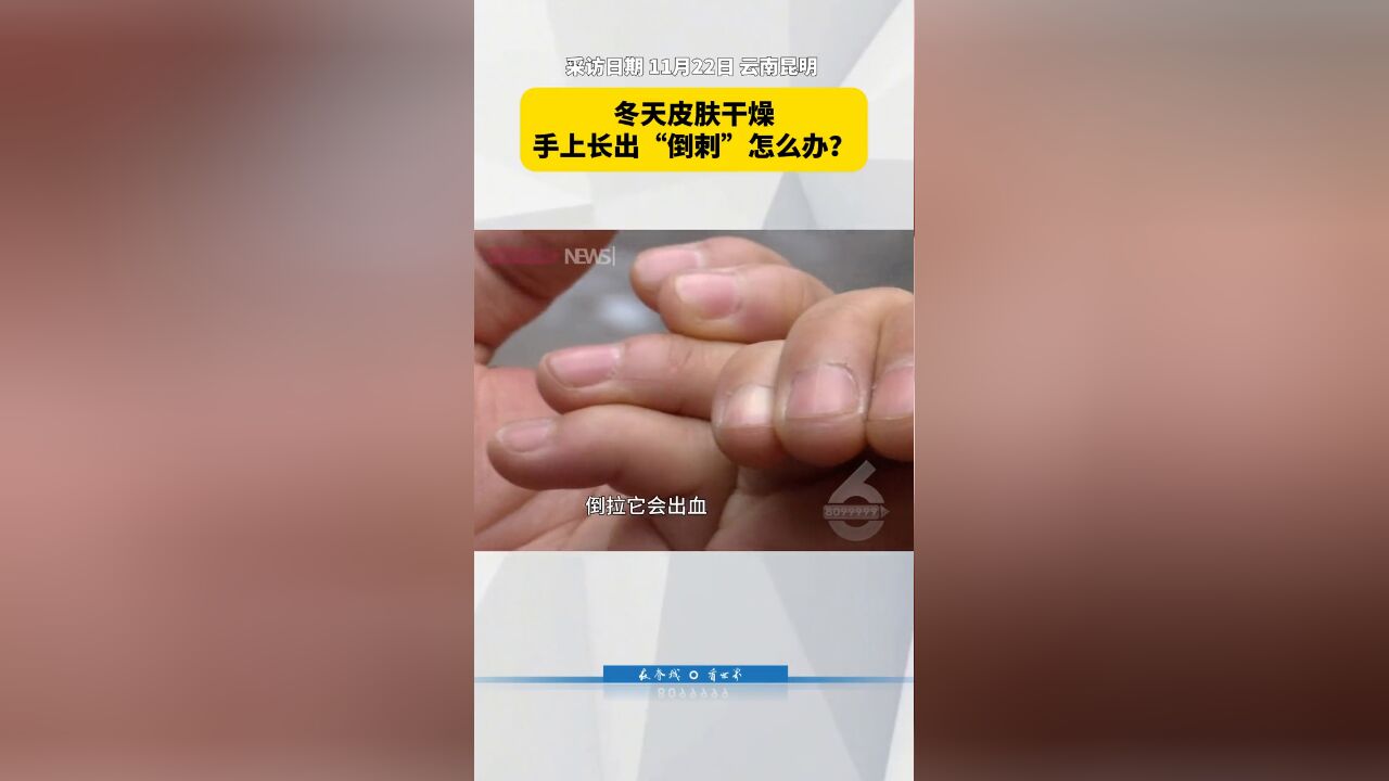 冬天皮肤干燥,手上长出“倒刺”怎么办?