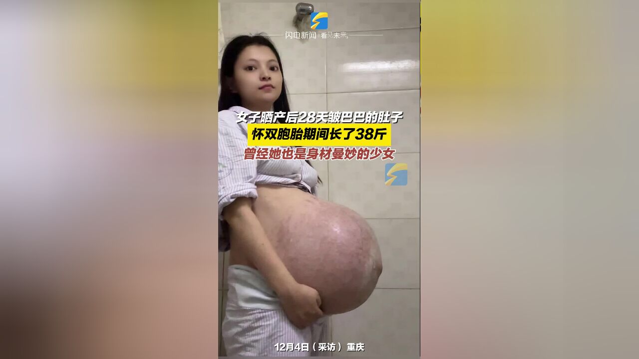 女子晒产后28天皱巴巴的肚子 怀双胞胎期间长了38斤