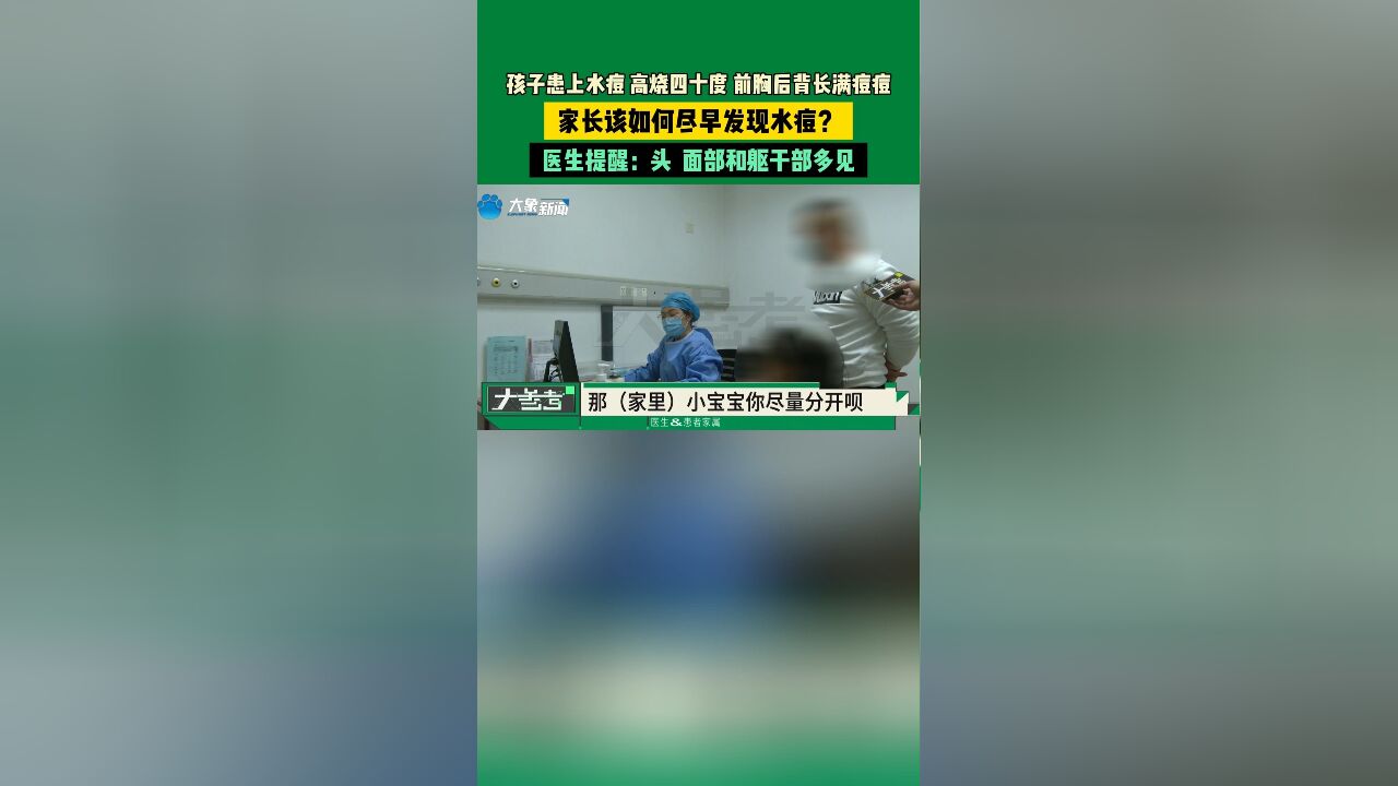 孩子患上水痘,高烧四十度,前胸后背长满痘痘,家长该如何尽早发现水痘?医生提醒:水痘有向心性分布特点,头面部和躯干部多见