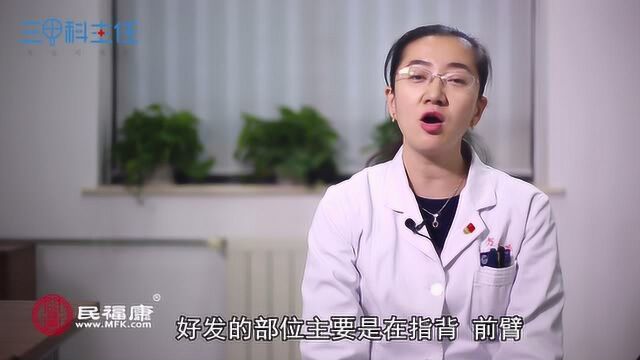 什么是白癜风?