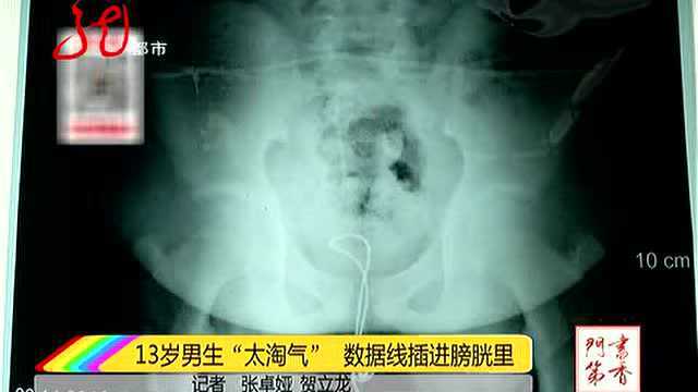 13岁男生“太好奇” 数据线插进尿道里取不出