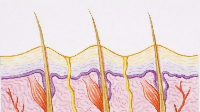 毛孔发红、摸起来不平滑,很可能是毛囊角化症!