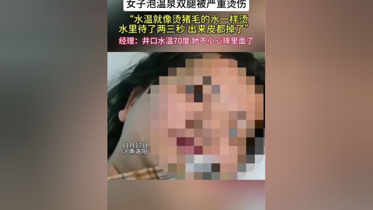 女子泡温泉双腿被严重烫伤 经理:井口水温70度 她不小心摔里面了