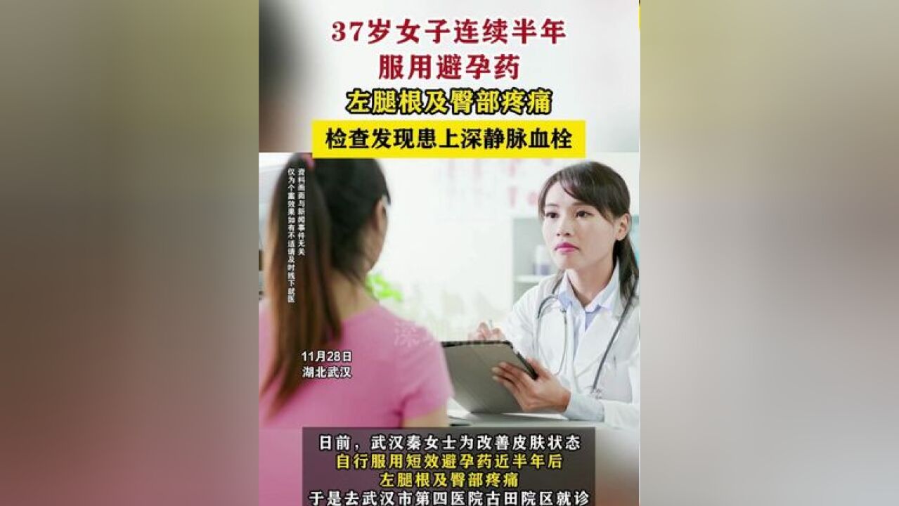 37岁女子连续半年服用避孕药左腿根及臀部疼痛 检查发现患上深静脉血栓