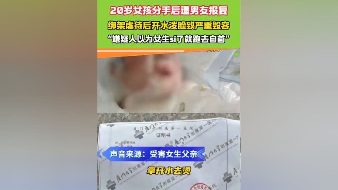 20岁女孩分手后遭男友报复,绑架虐待后开水泼脸致严重毁容 #恶劣行为 #分手后