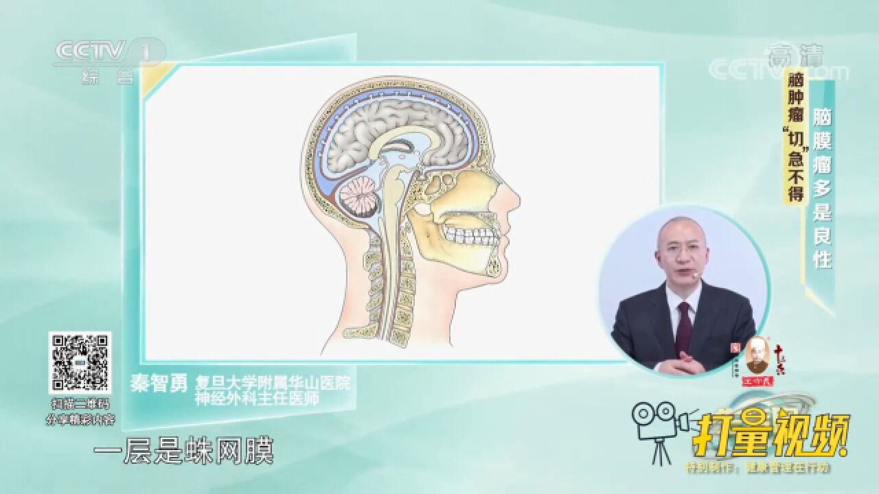 脑膜瘤绝大部分是良性的,它大约占颅内肿瘤的20%30%左右