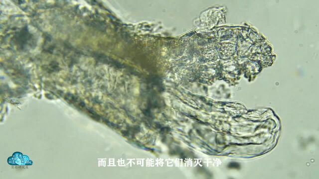 脸上的螨虫长什么样太恐怖了,放大镜下观察太刺激了