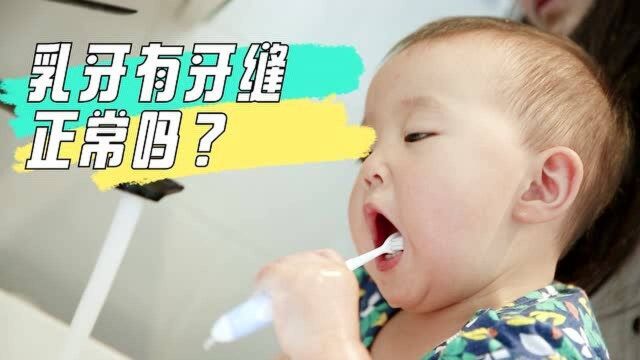 宝宝乳牙间有缝隙该怎么办?是正常的状态吗?