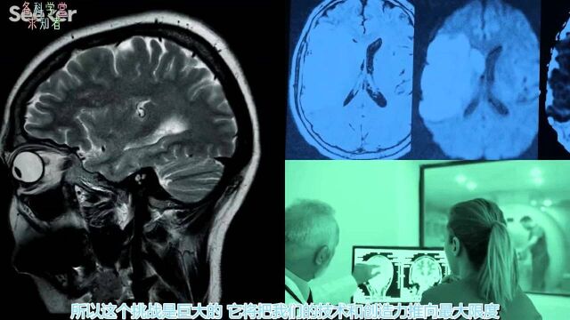 我们能够完整的绘制人脑功能图吗?求知者课堂系列