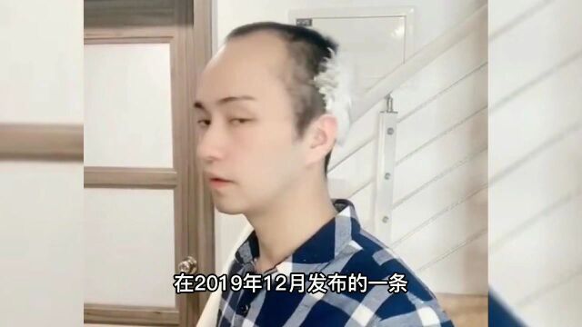 全网最帅秃头男,粉丝众筹让他植发,变装后让人直呼不敢相信!