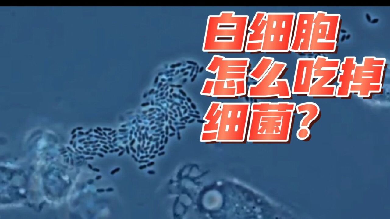 震撼!白细胞是如何“吃掉”有害细菌的?!显微镜下观察!极度舒适!