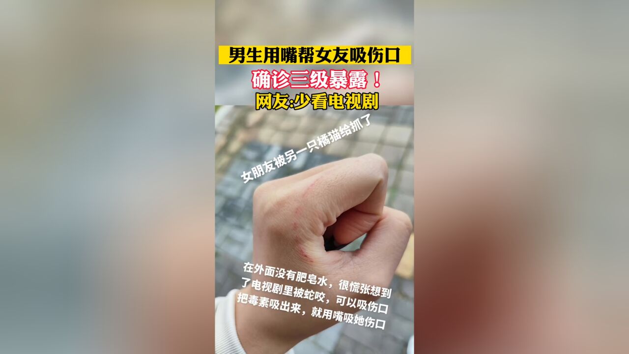 男生用嘴帮女友吸伤口,确诊三级暴露!