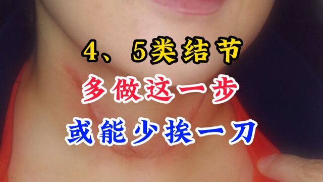 4类、5类甲状腺结节,牢记1点或能少挨一刀,早了解早受益