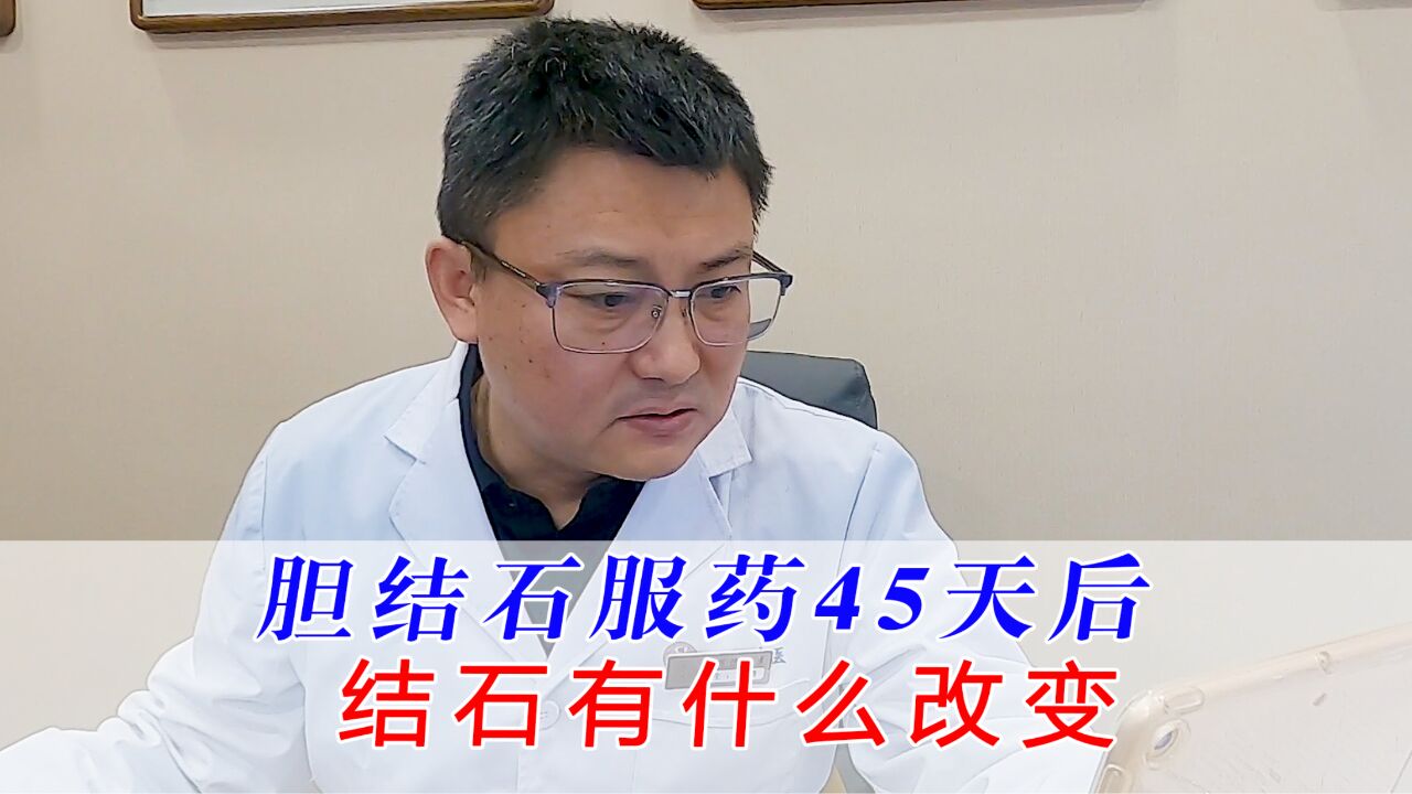 胆结石患者服中药45天后,结石有什么改变