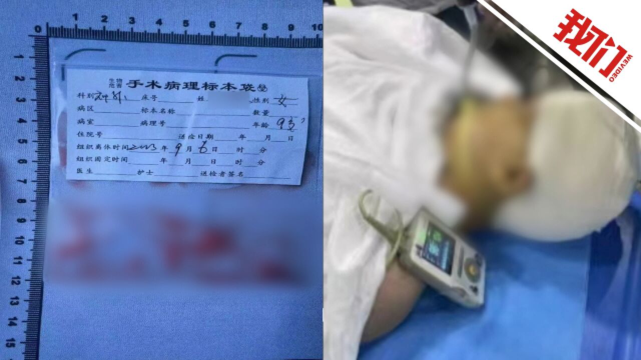 长沙一小学生额头被老师打伤:涉事教师被停职并接受警方调查