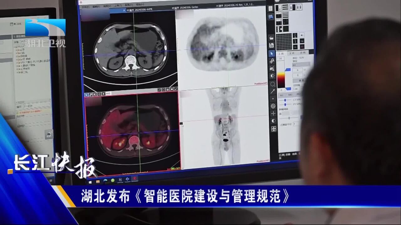 湖北发布《智能医院建设与管理规范》