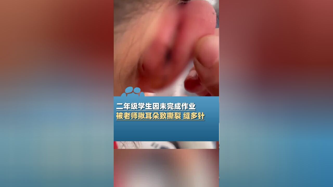 小学生未完成作业被老师揪耳朵致撕裂缝针,教育局:老师知道错了,警方已介入