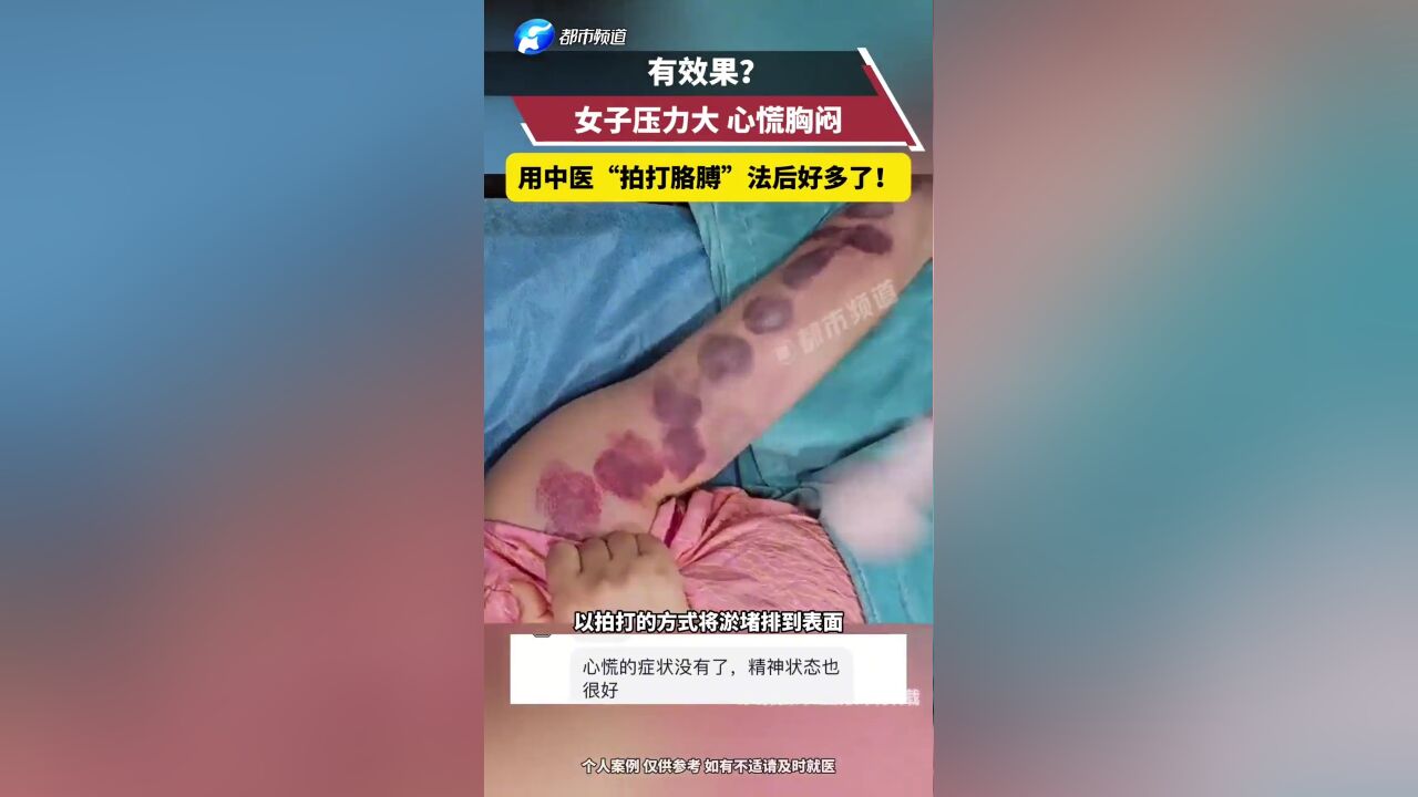 女子压力大心慌胸闷 用中医“拍打胳膊”法后好多了!