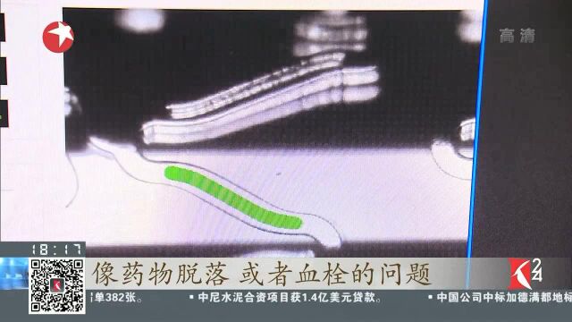 中国医疗器械首登《柳叶刀》中国造心脏支架解决冠心病治疗世界性难题